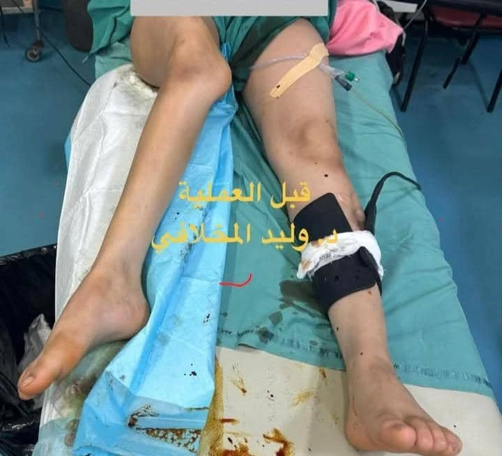 صوره القبل العمليه