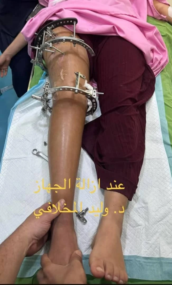 صوره بعد العمليه