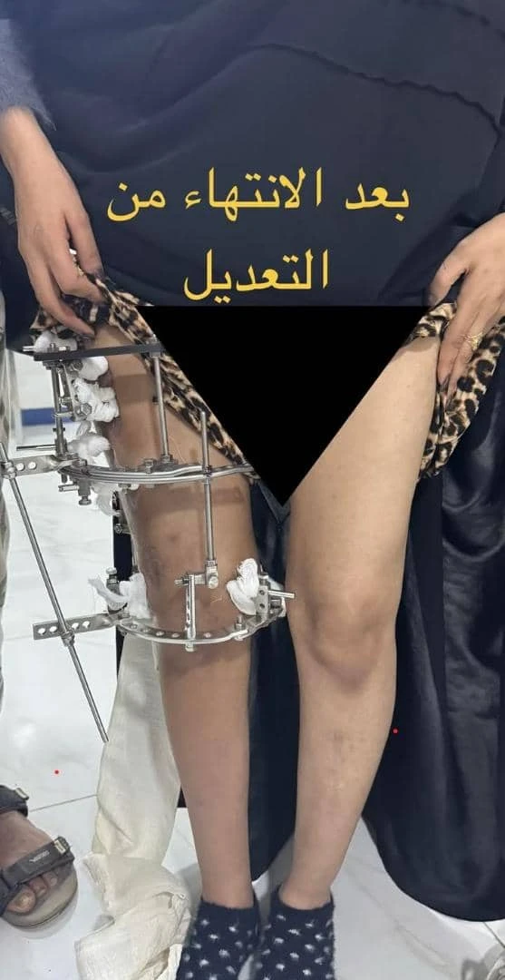 صوره بعد الانتهاء من التعديل